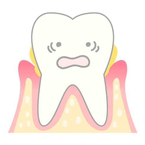 歯周病・骨の吸収